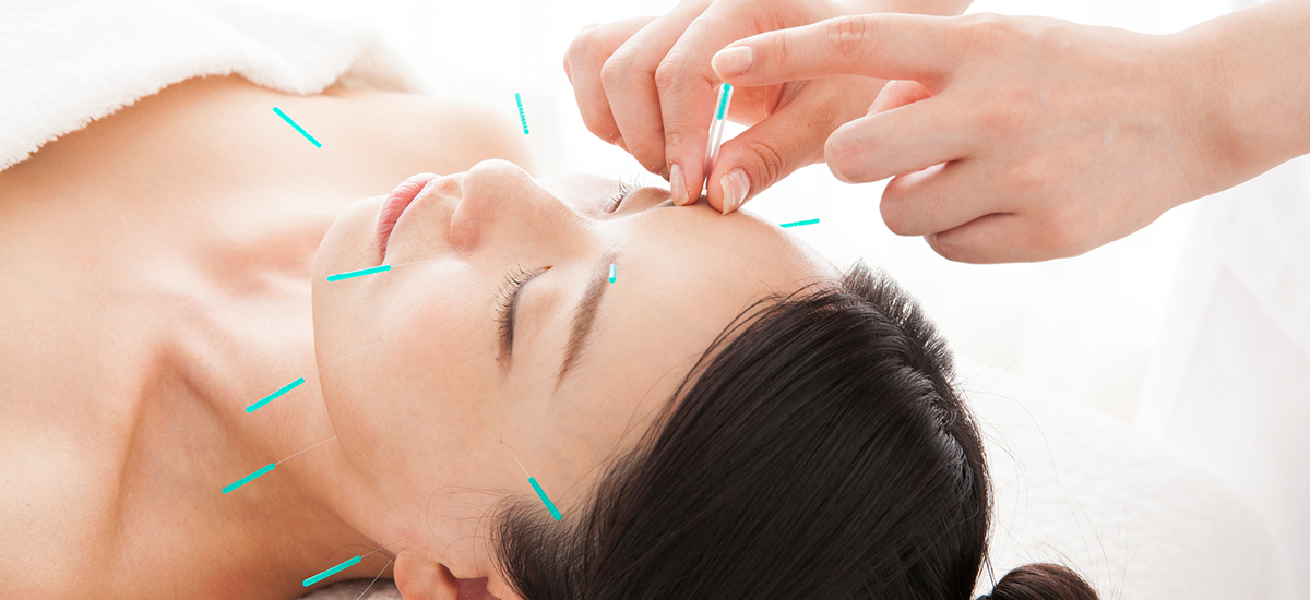 鍼灸院のホームページ制作の４ステップ